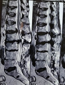 Back pain guadalajara